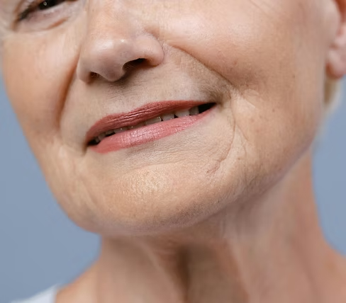 Close-up showing fine lines that Botox can treat